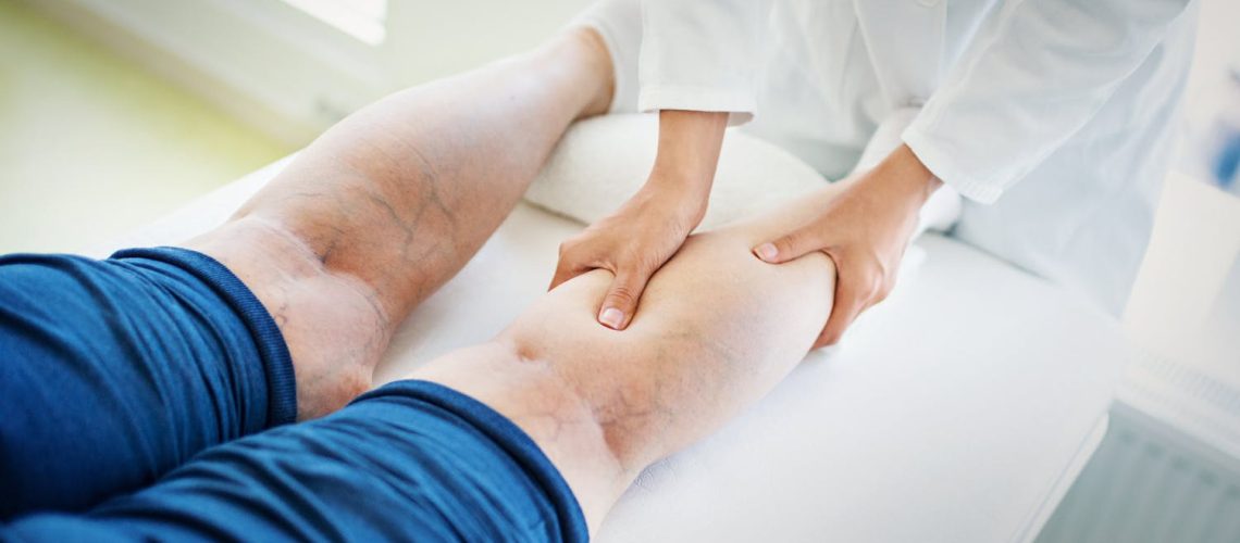 Qu'est-ce que l'angiologie ? Quanc onsulter un angiologue ?